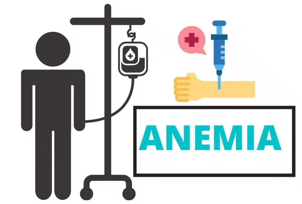anemia