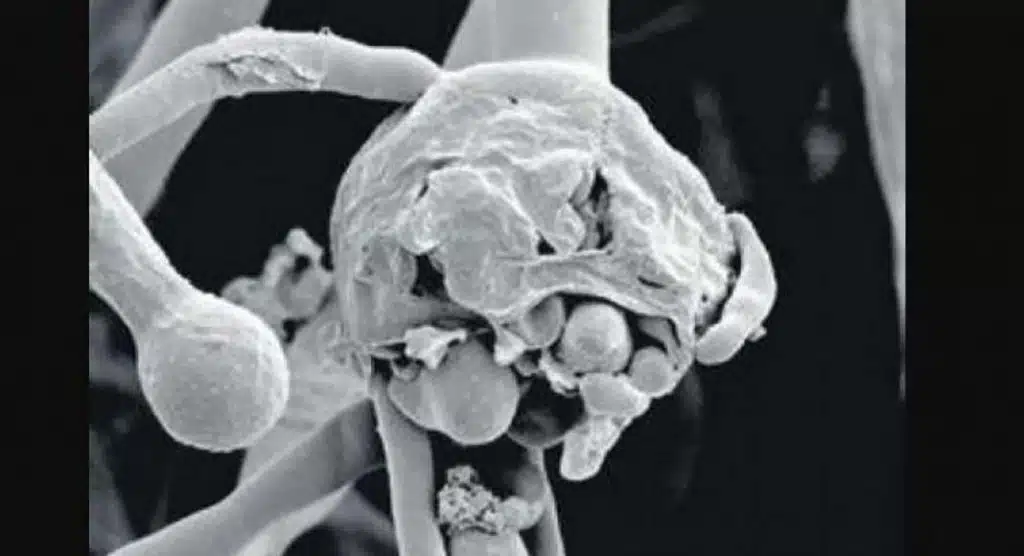 White fungus and yellow fungus