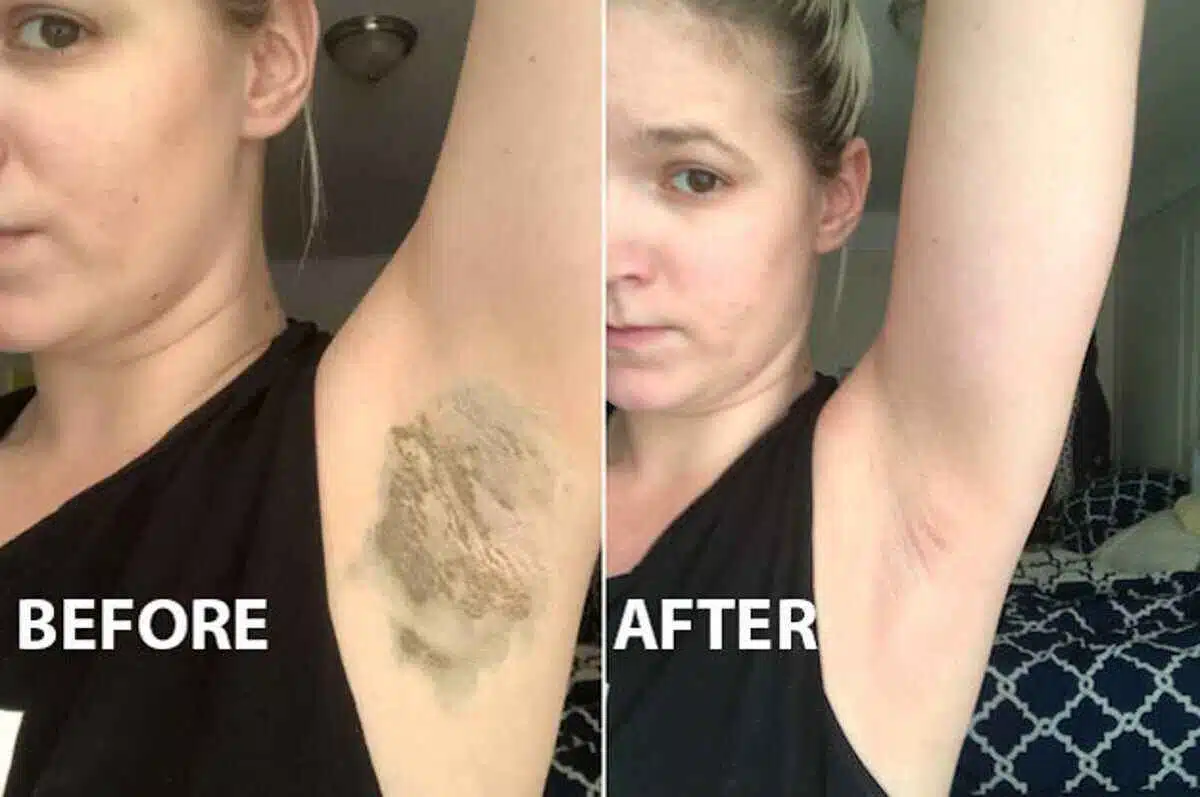 Armpit Detox