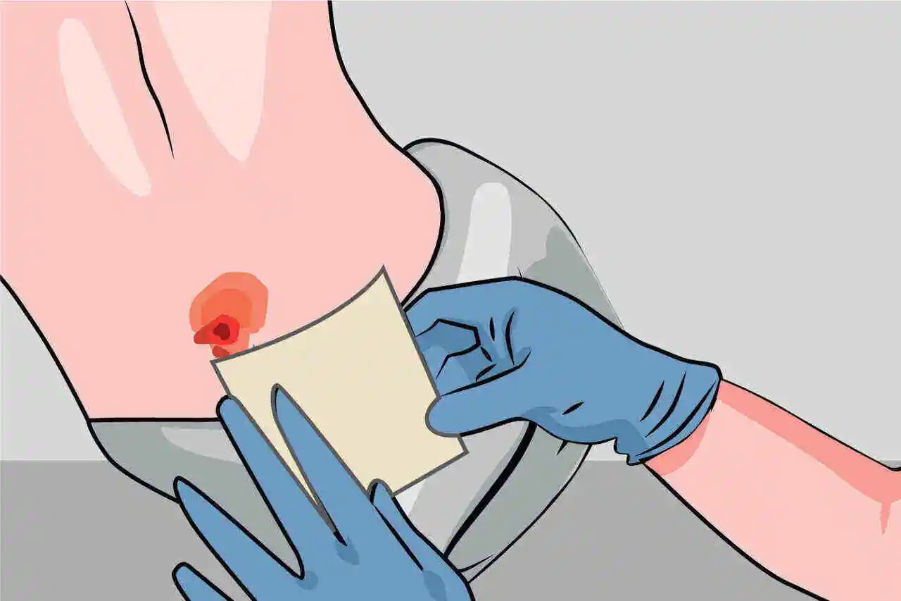 Wound Care Management