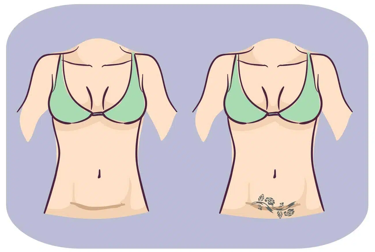 scar cover up tattoos