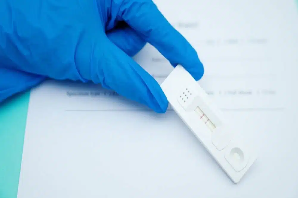 Antigen Test