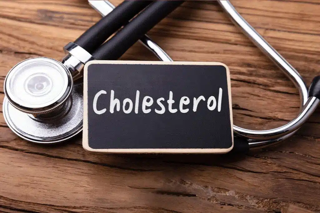 Cholesterol