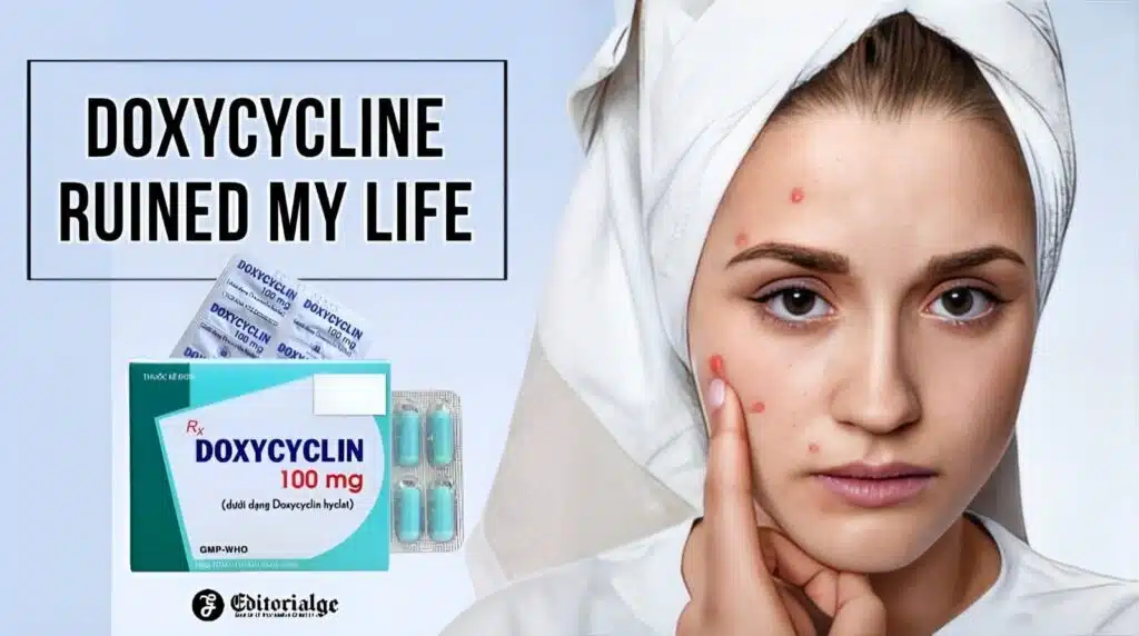 Doxycycline ruined my life