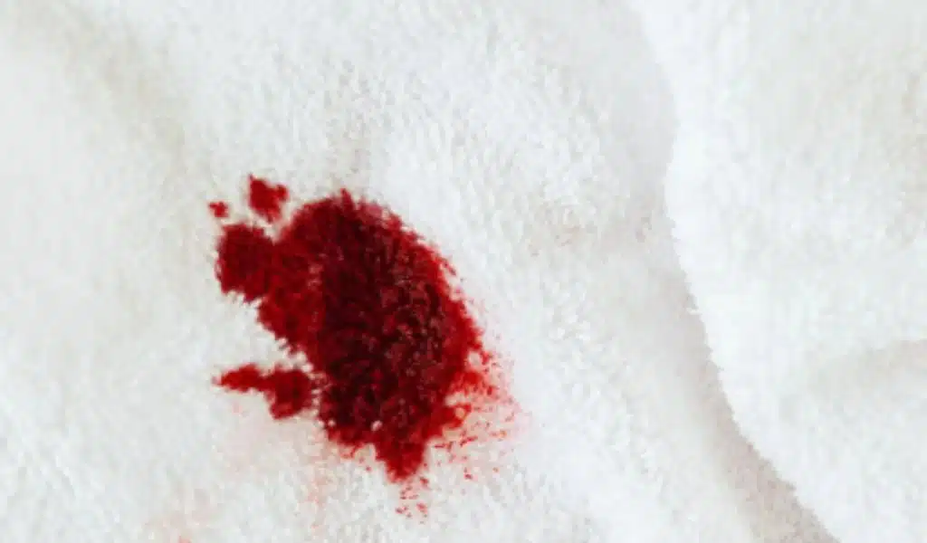 How to Remove Blood Stains