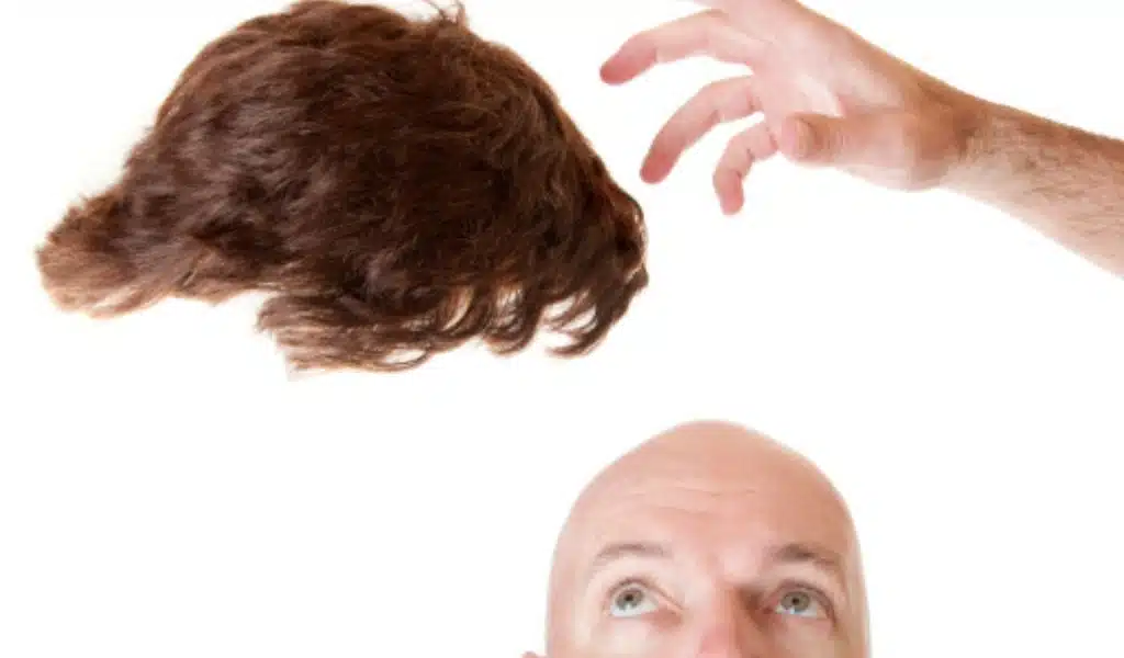 How to Install Toupees