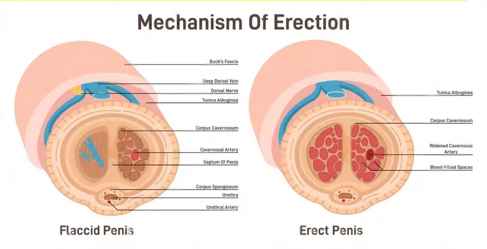 Erection Mechanism