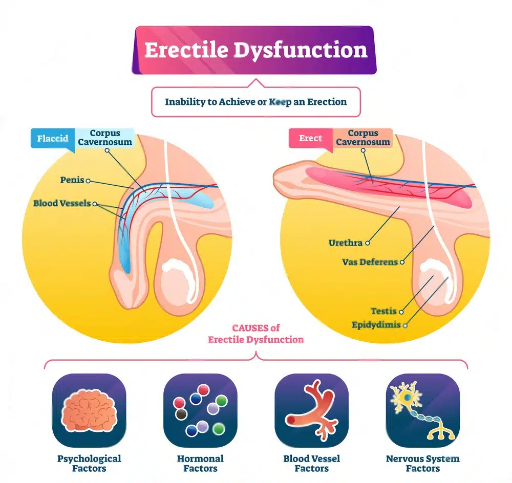Erectile Dysfunction