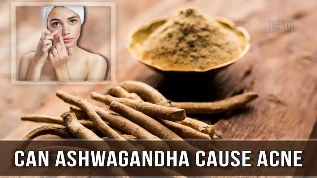 can ashwagandha cause acne
