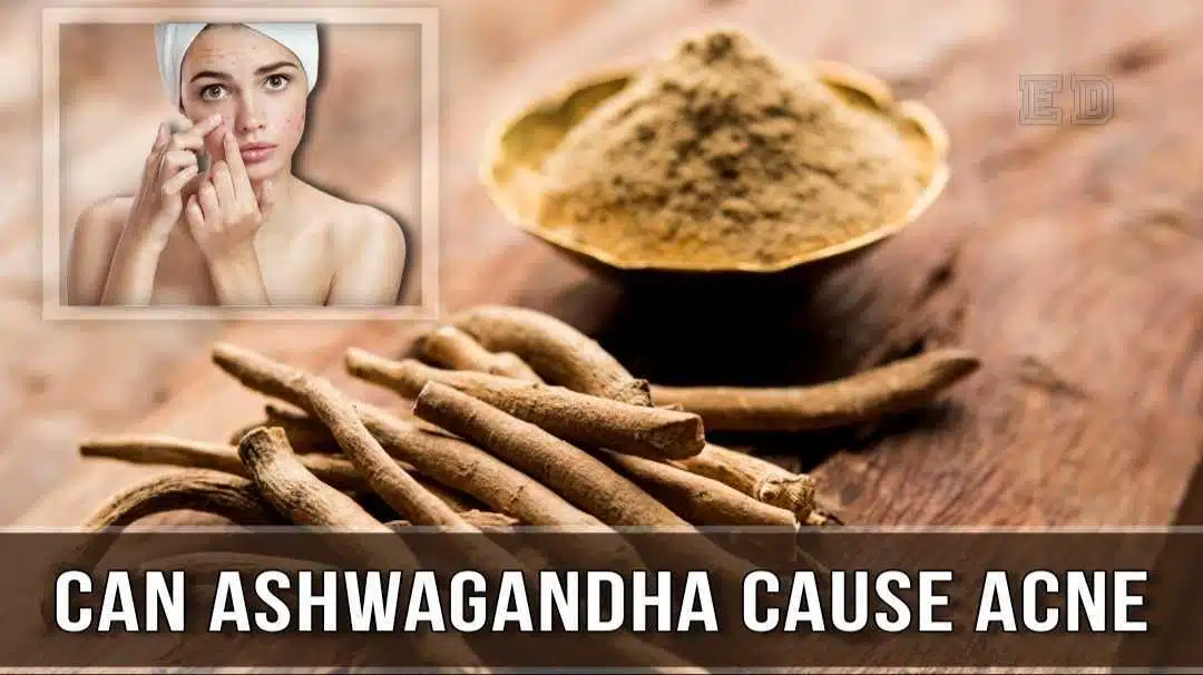 can ashwagandha cause acne