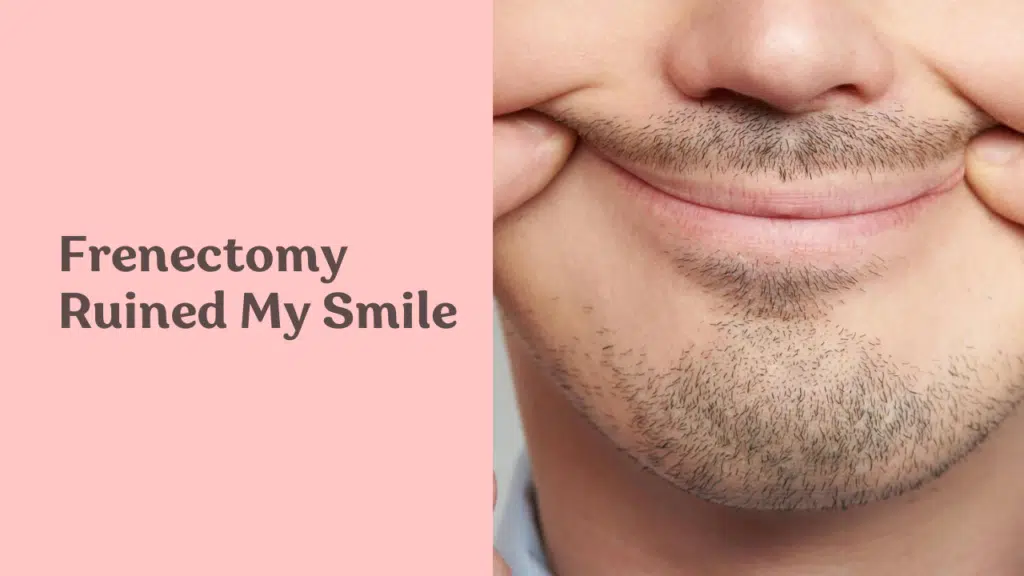 frenectomy ruined my smile