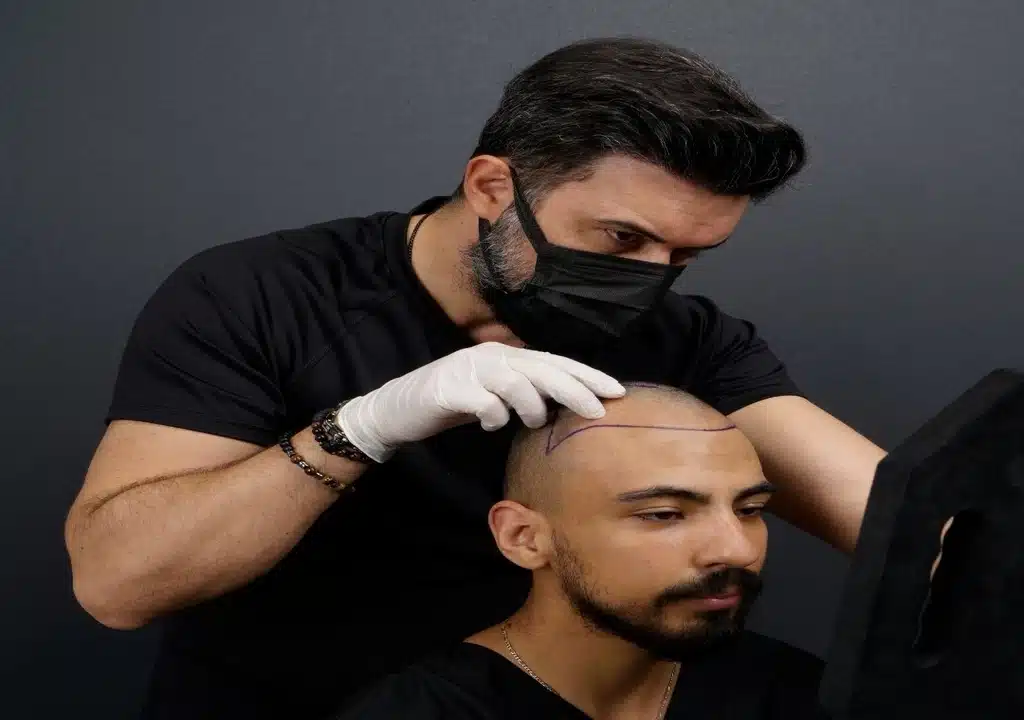 Hair Transplant Turkey Vera Clinic