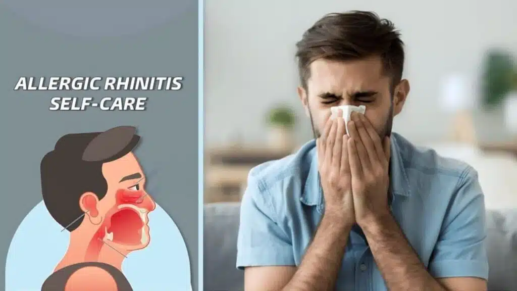 Allergic Rhinitis self-care