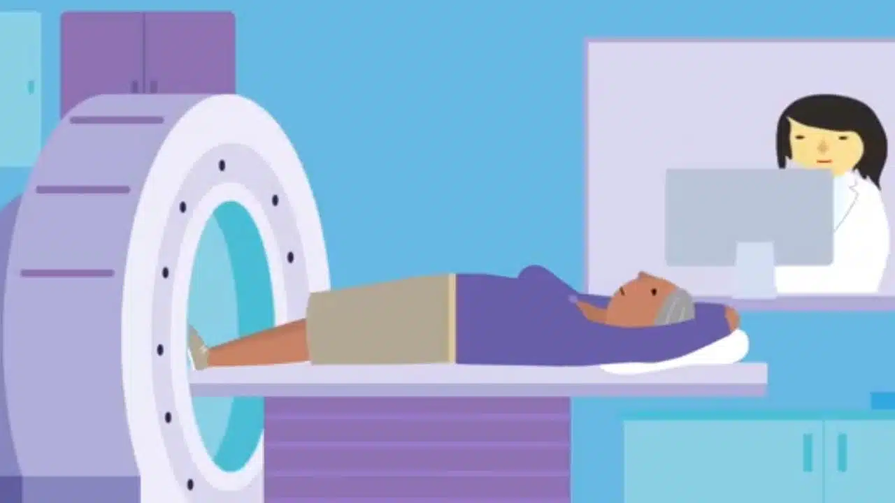 Latest Updates ACS Lung Cancer Screening