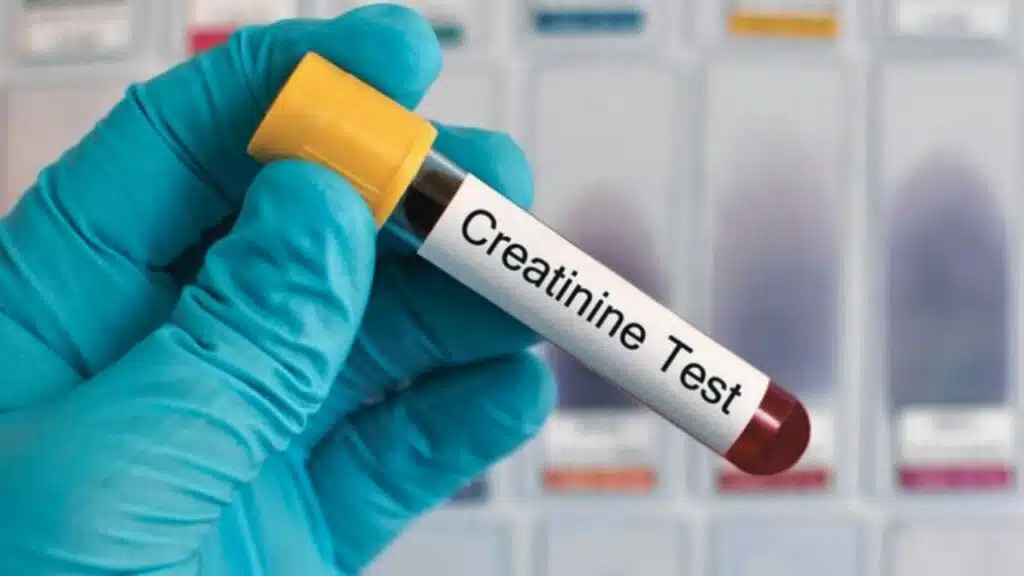 Maintain Healthy Creatinine Levels