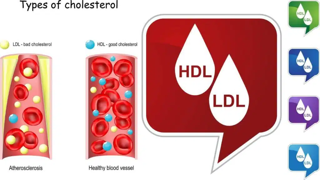 Things to Know About Cholesterol