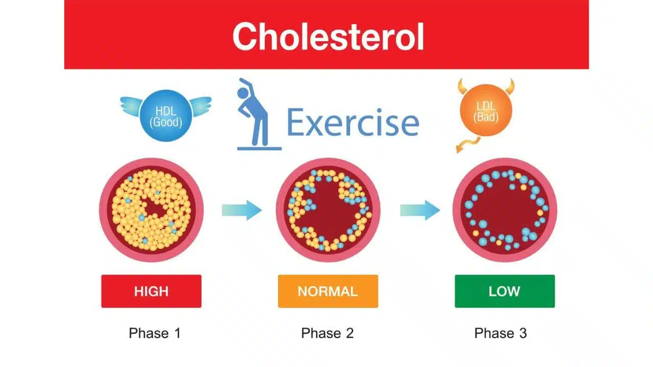 Things to Know About Cholesterol