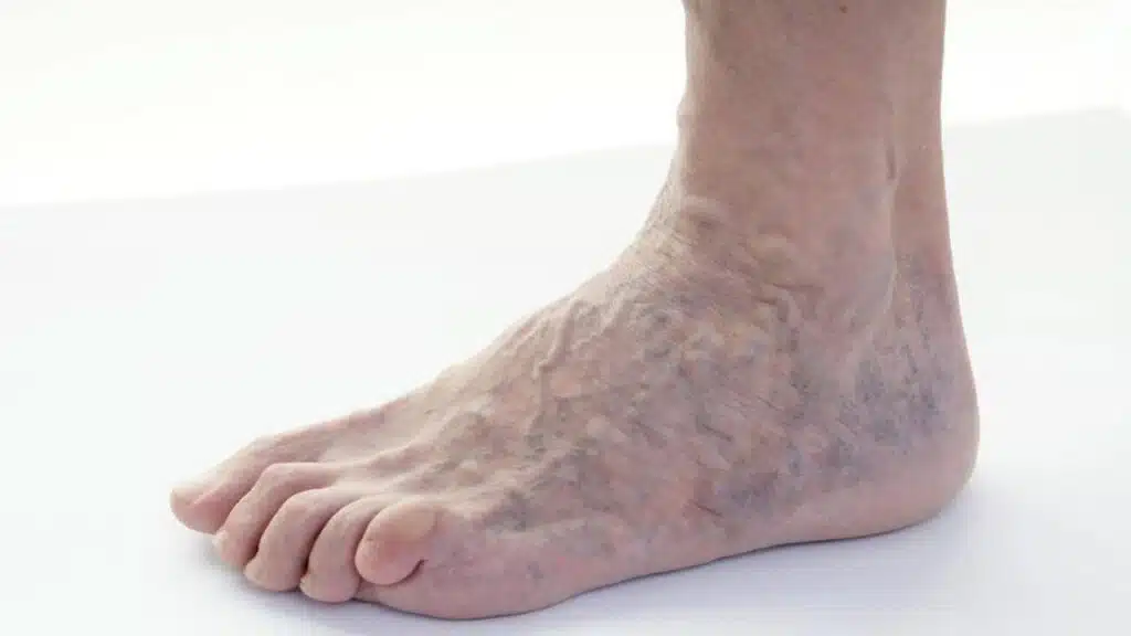 Most Searched Health Questions on Google