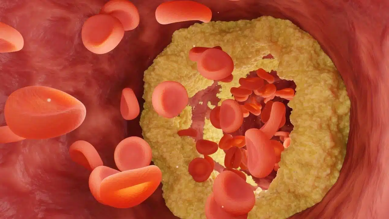 Things to Know About Cholesterol