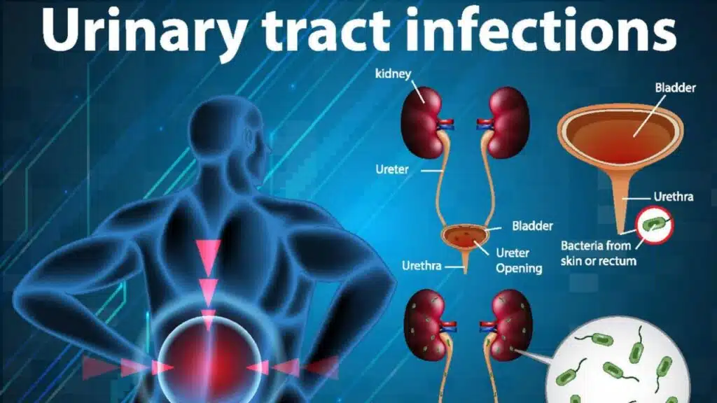 Prevent and Treat UTIs