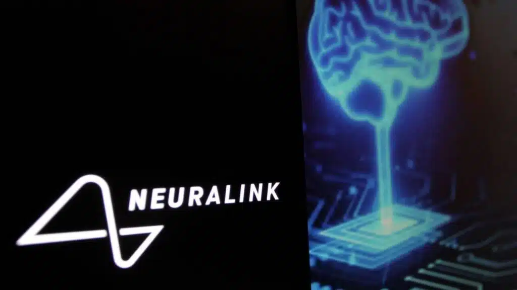 Neuralink First Brain Chip Scientists Reactions