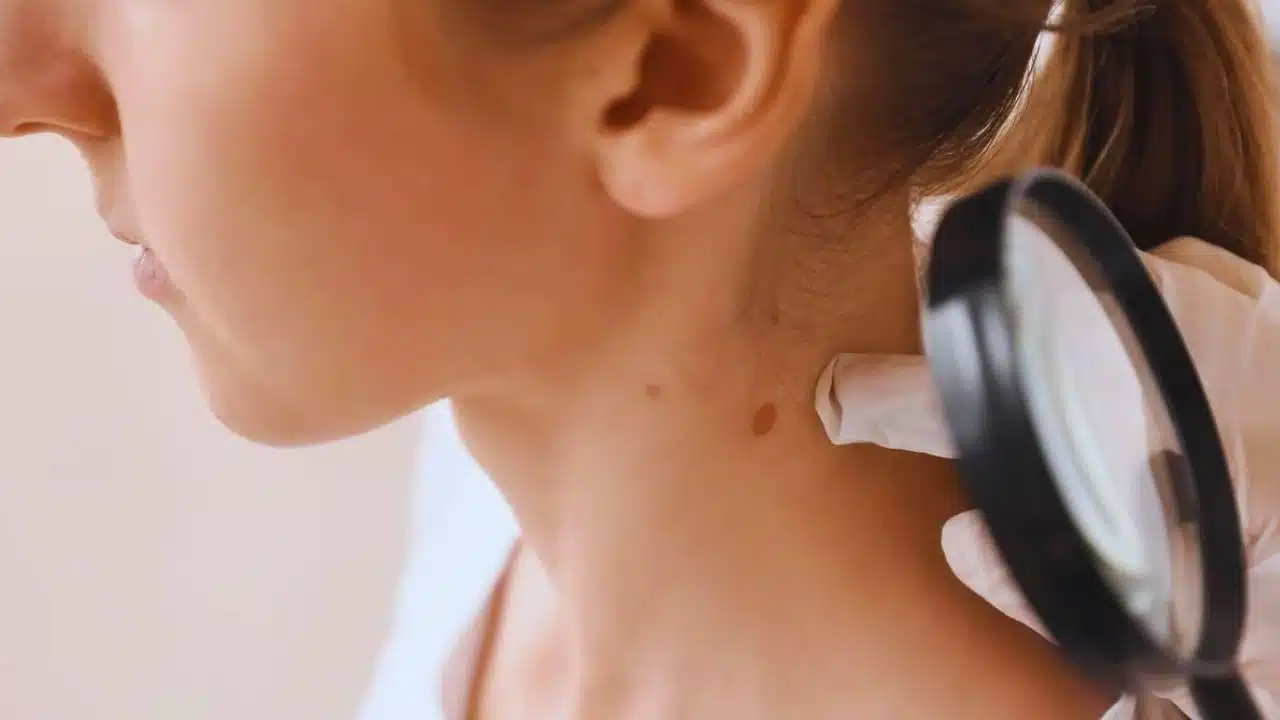 Most Ignored Cancer Symptoms