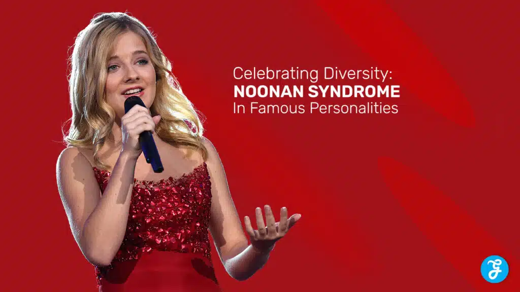 celebrities with noonan syndrome