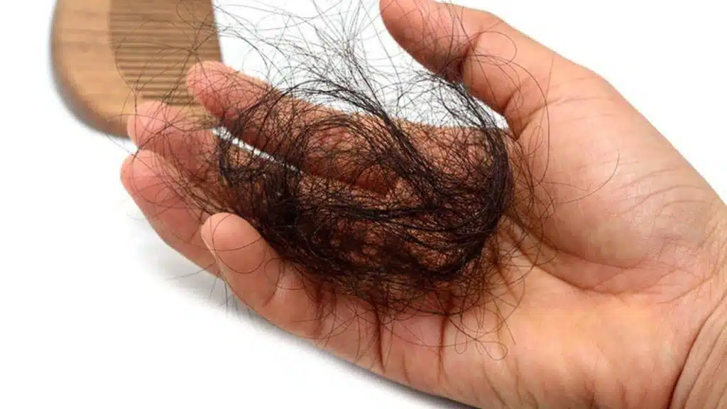 Keratin Rich Foods to Fight Hair Loss