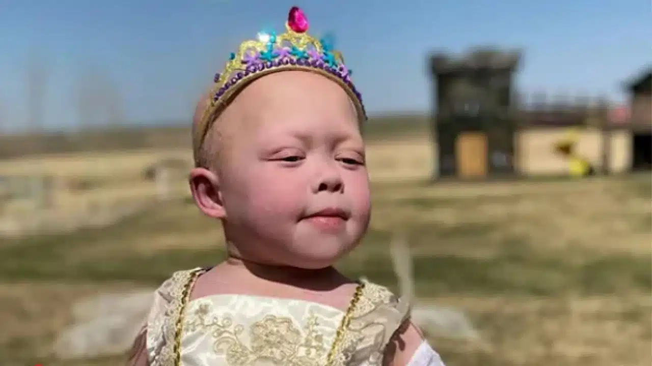 Tiktok Star Bella Brave Dies Rare Health Issues