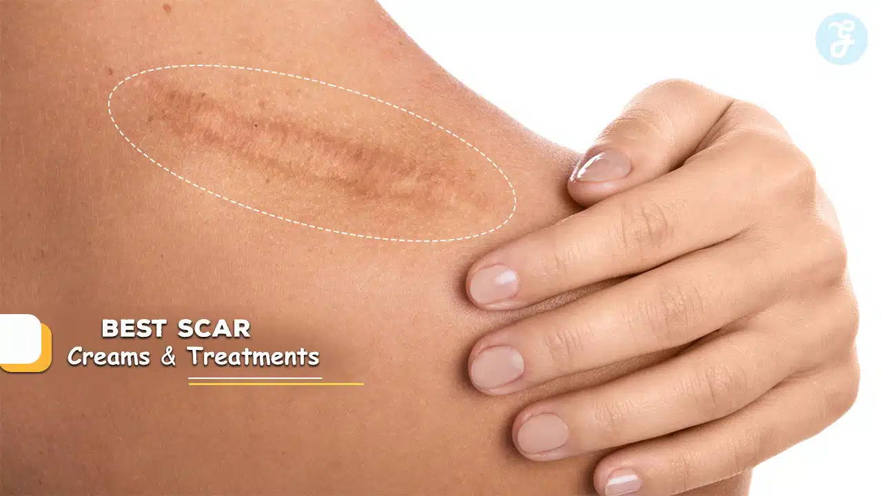 Best Scar Creams and Treatments 2024