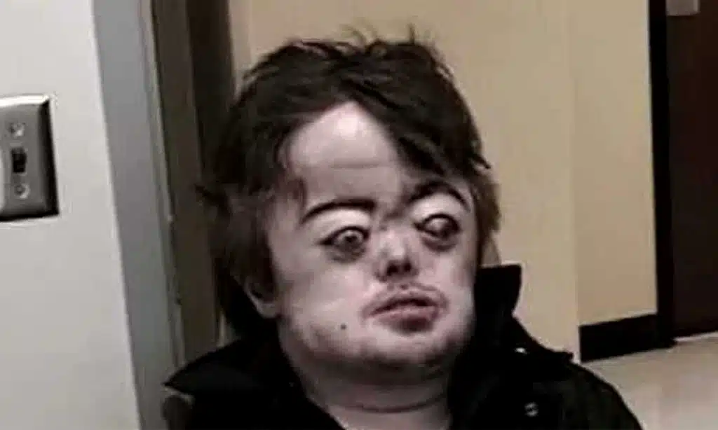 brian peppers disease