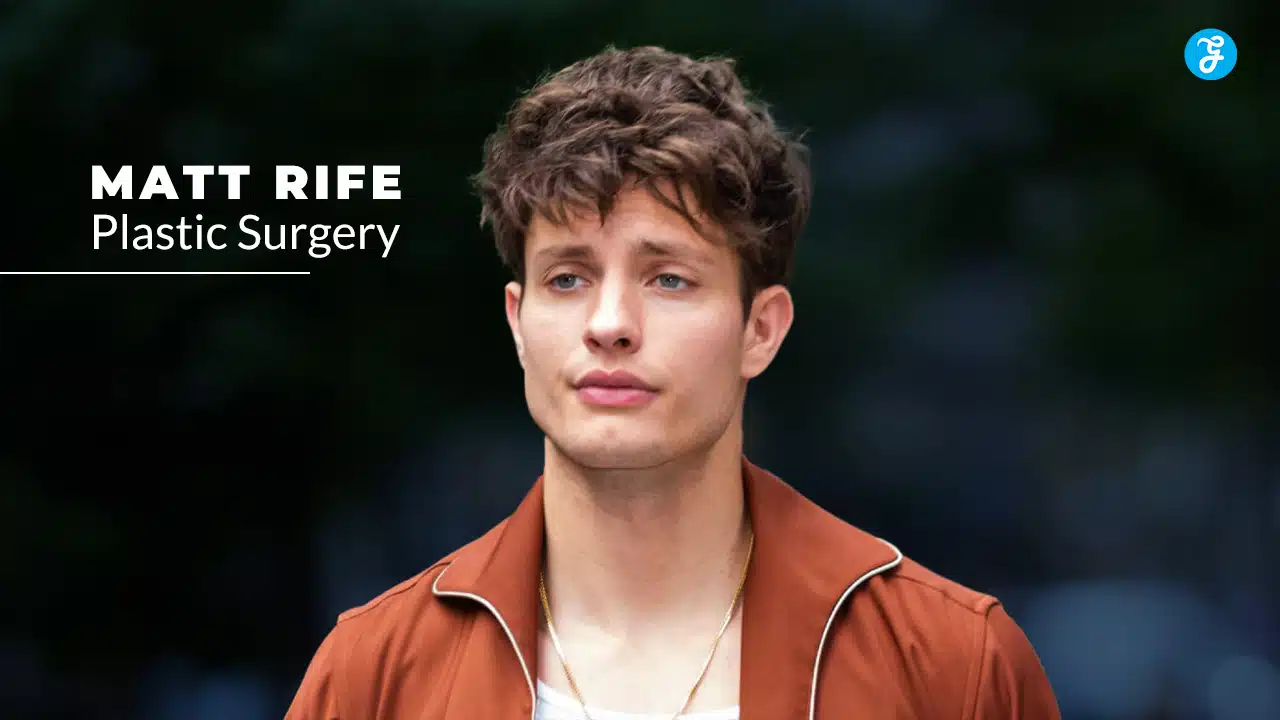 matt rife plastic surgery