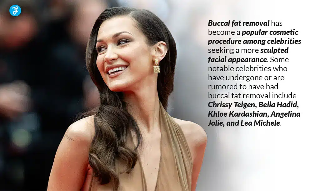 top celebrities who undergo buccal fat removal