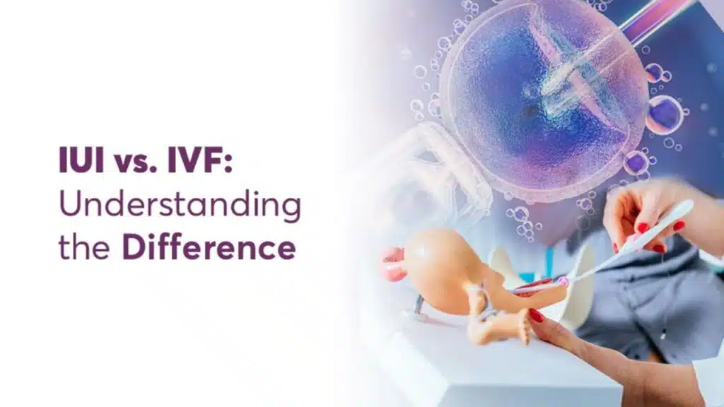 IUI vs. IVF