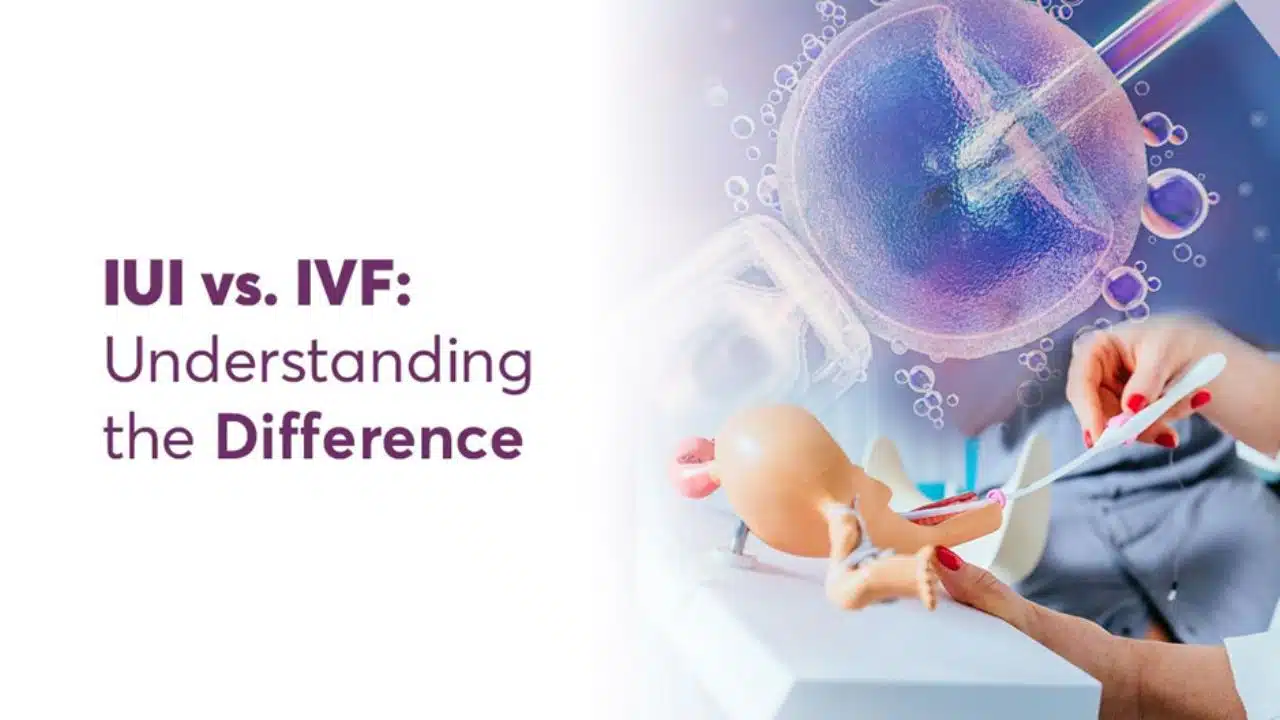 IUI vs. IVF
