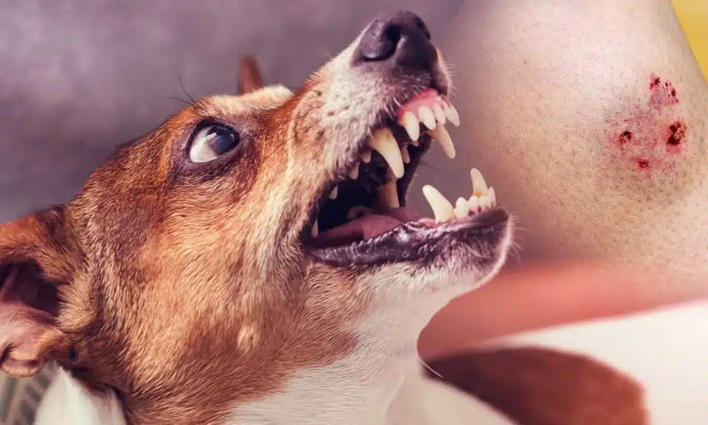 Top 10 Dog Bite Lawyers in Los Angeles in 2025