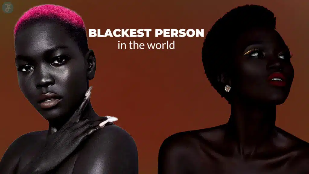 blackest person in the world