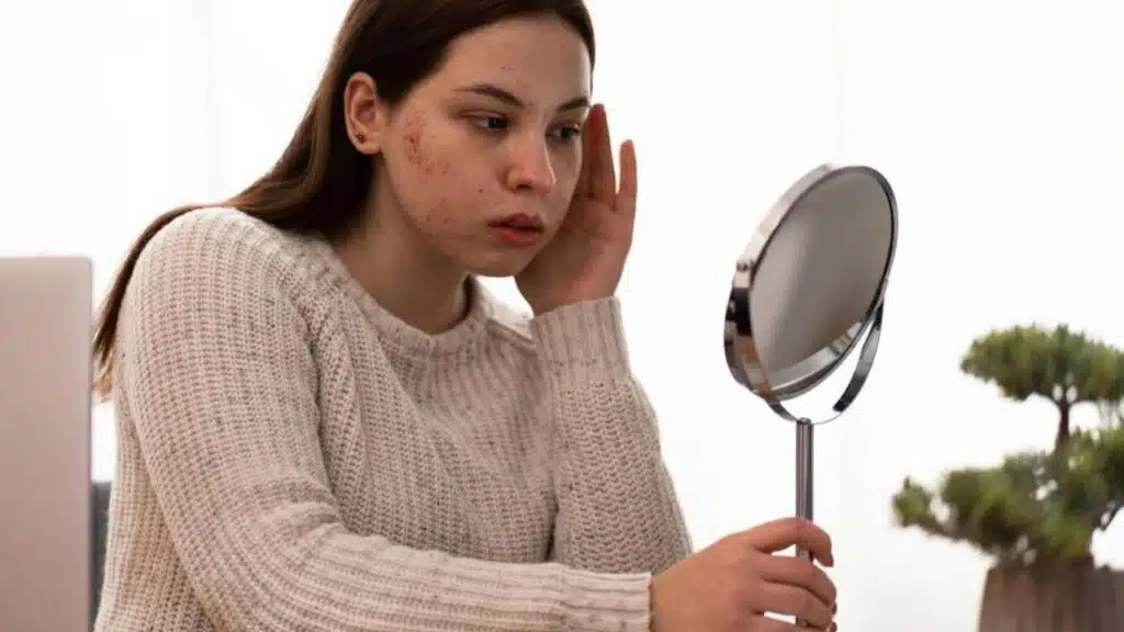 How to Recognize When Accessories Causing Skin Reactions