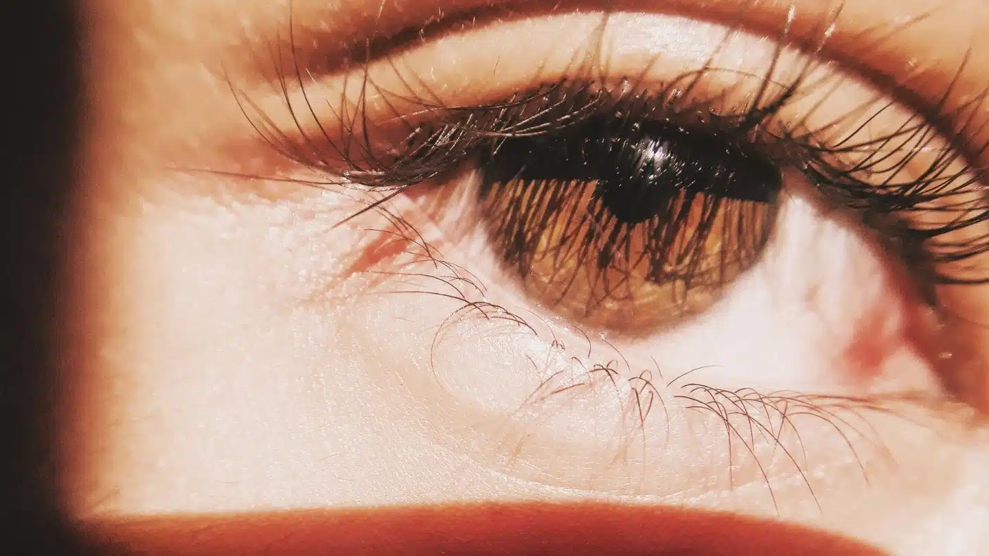 What Are The Causes And Symptoms of Brown Spots On Eyes