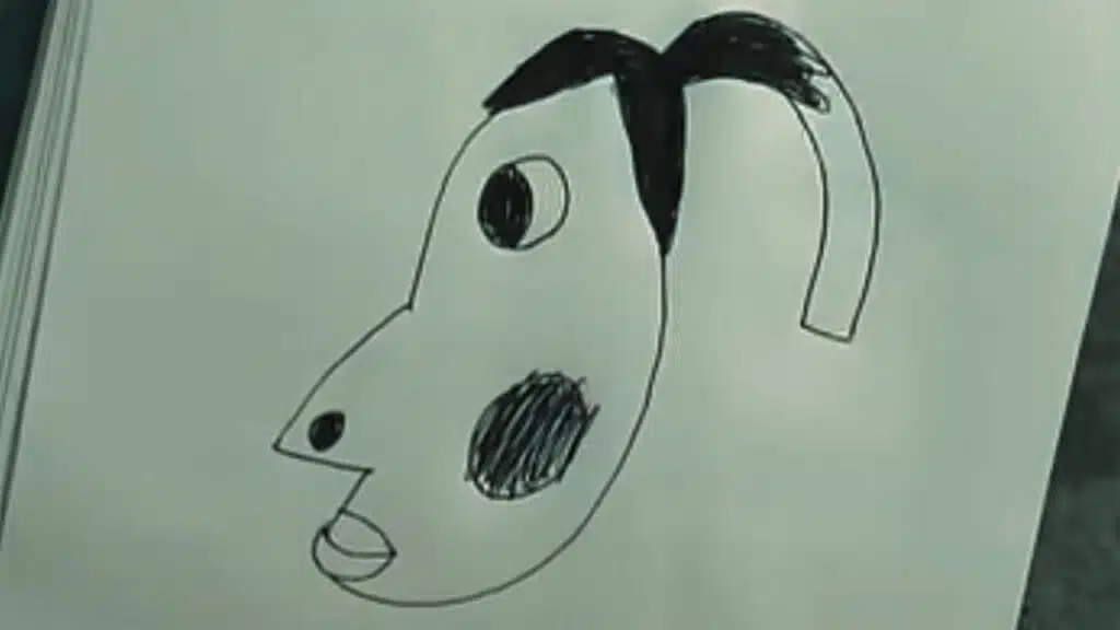 what does hyperpigmentation mean meme