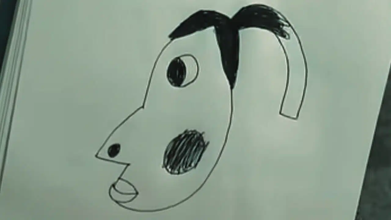 what does hyperpigmentation mean meme