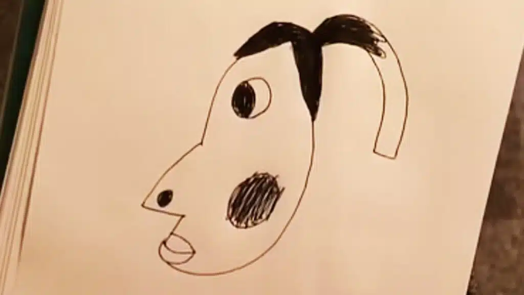 what is hyperpigmentation meme