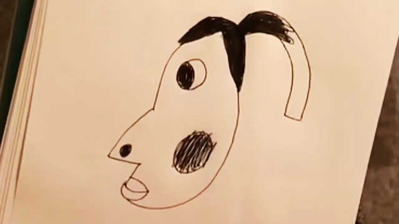 what is hyperpigmentation meme