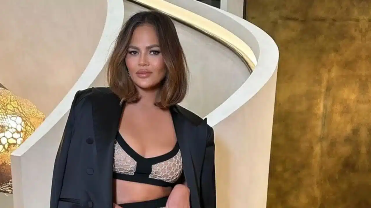 How Old is Chrissy Teigen