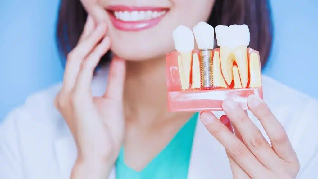 Molar Implant Healing Timeline