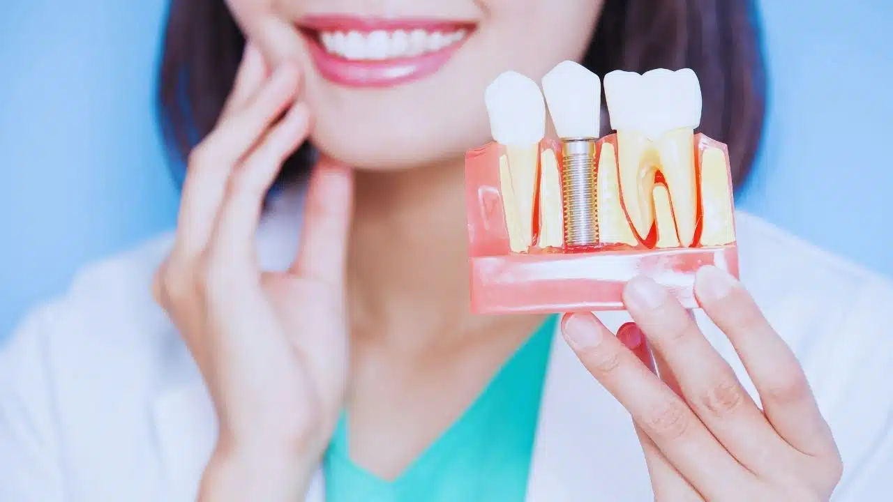 Molar Implant Healing Timeline