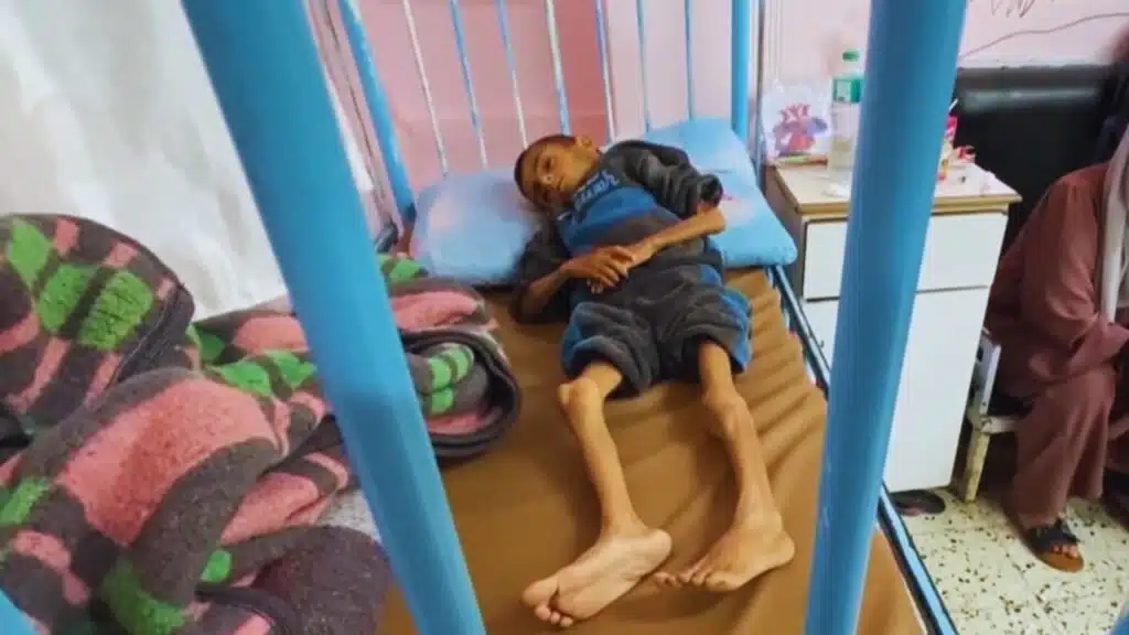 Gaza child malnutrition deaths
