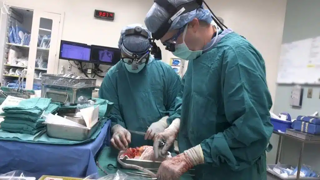 DCD heart transplant preservation