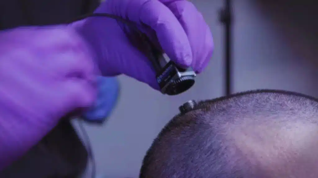 Man Finds Joy After 30 Years With Brain Stimulation Depression Treatment