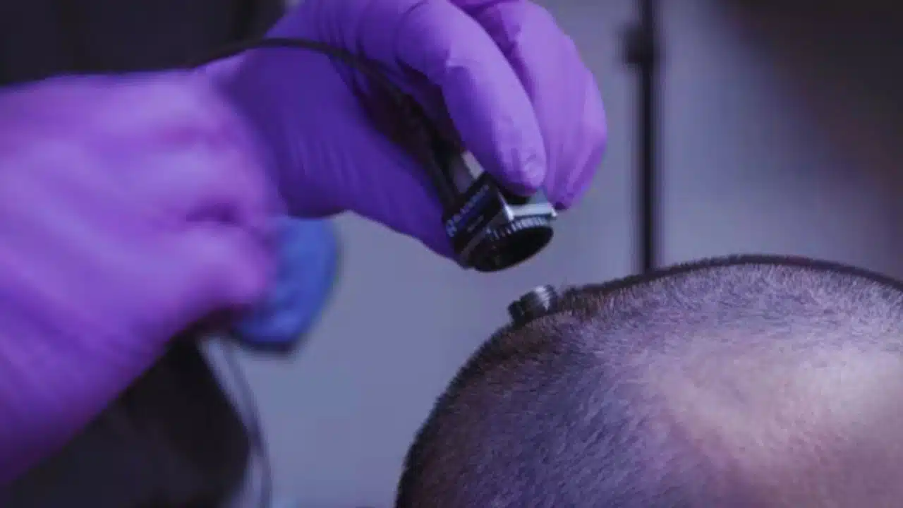 Man Finds Joy After 30 Years With Brain Stimulation Depression Treatment